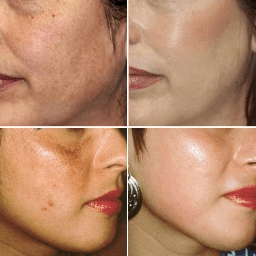 eska group batam eska aesthetic clinic & medispa WhatsApp Image 2019-01-15 at 07.37.05
