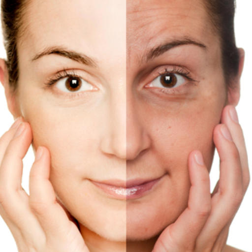 eska group batam eska aesthetic clinic & medispa  advance-machine-with-ptf-face-rejuvenation