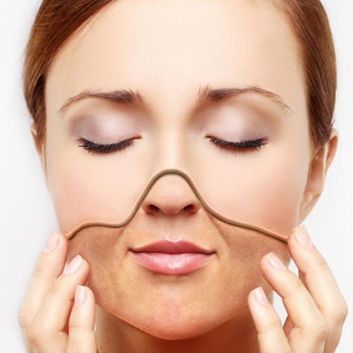 eska group batam eska aesthetic clinic & medispa advance-machine-with-ptf-bye2-wrinkles