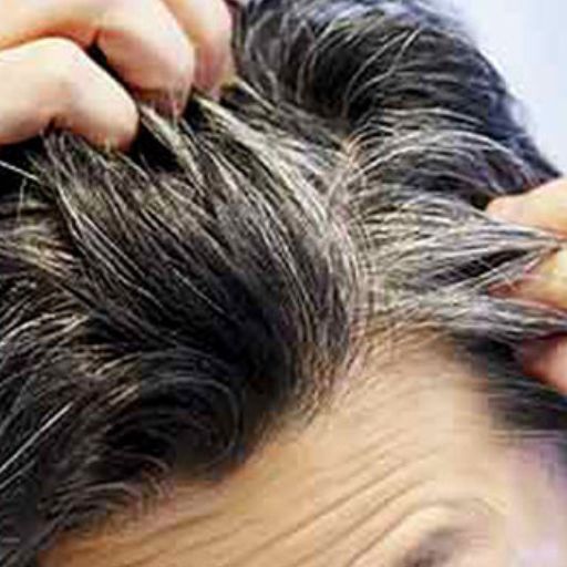 eska group batam eska aesthetic clinic & medispa 5-grey-white-5hair
